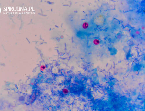 Kryptosporydioza