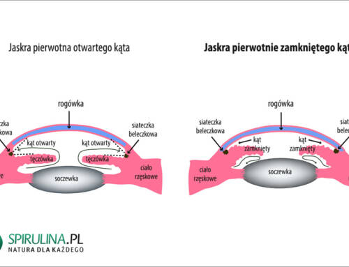 Jaskra pierwotnie zamkniętego kąta