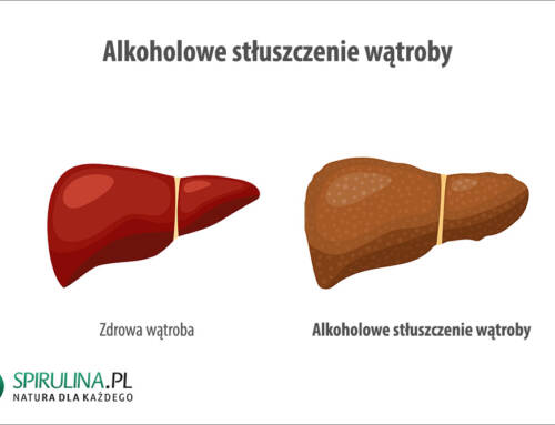 Alkoholowe stłuszczenie wątroby