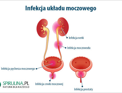 Infekcja układu moczowego