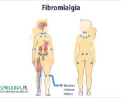 Fibromialgia