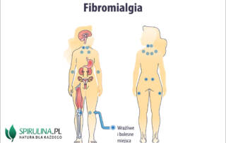 Fibromialgia