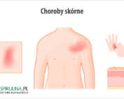 Choroby skórne