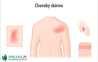 Choroby skórne
