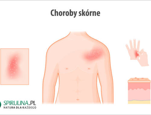 Choroby skórne