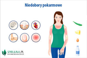 Niedobory pokarmowe