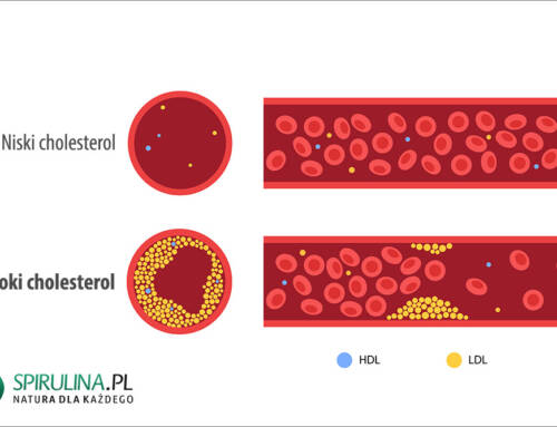 Wysoki cholesterol