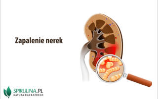 Zapalenie nerek