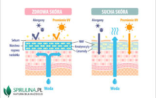 Sucha skóra