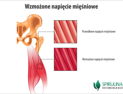 Wzmożone napięcie mięśniowe