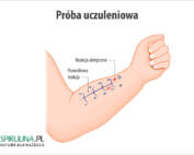Próba uczuleniowa