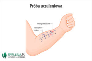Próba uczuleniowa