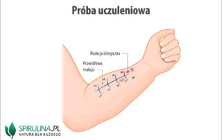 Próba uczuleniowa