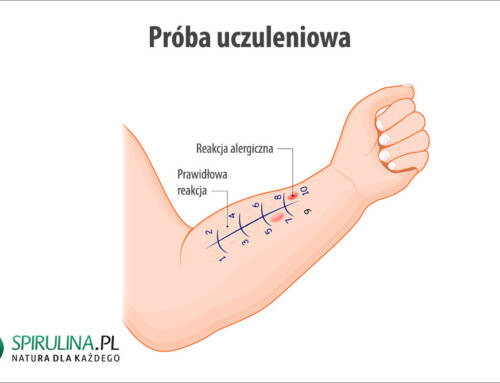 Próba uczuleniowa