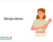 Alergia skórna