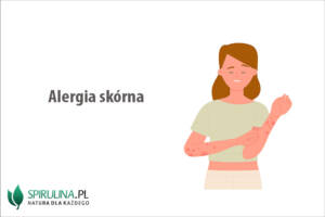 Alergia skórna
