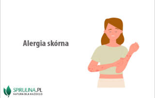 Alergia skórna
