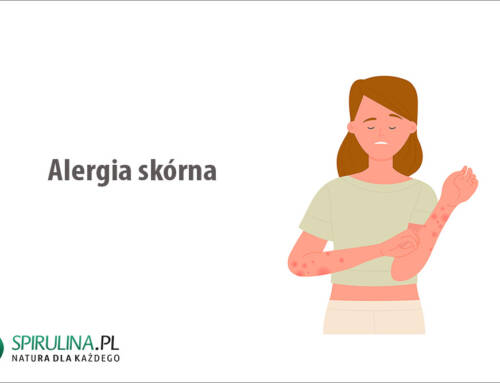 Alergia skórna