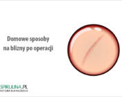Domowe sposoby na blizny po operacji