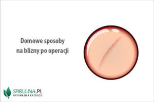 Domowe sposoby na blizny po operacji