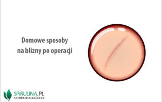 Domowe sposoby na blizny po operacji