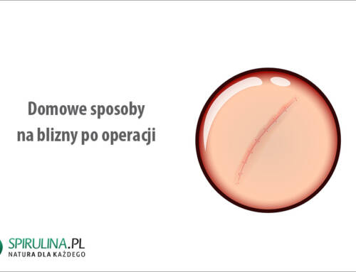 Domowe sposoby na blizny po operacji
