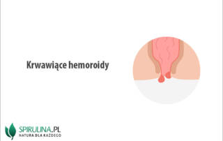 Krwawiące hemoroidy