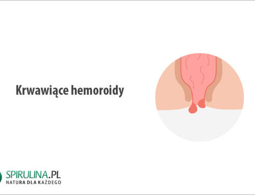 Krwawiące hemoroidy