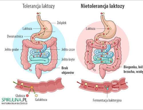 Nietolerancja laktozy