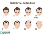 Skala Norwooda-Hamiltona