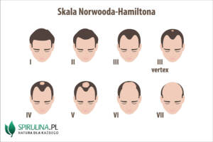 Skala Norwooda-Hamiltona