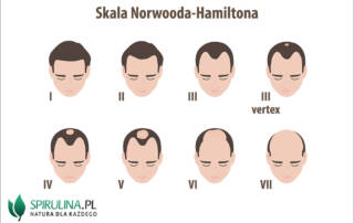 Skala Norwooda-Hamiltona