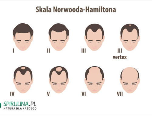 Skala Norwooda-Hamiltona