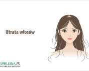 Utrata włosów