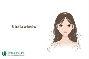 Utrata włosów