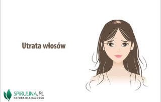 Utrata włosów