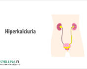 Hiperkalciuria