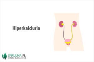 Hiperkalciuria Hiperkalciuria