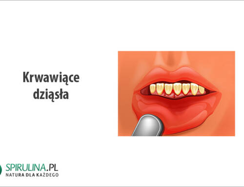Krwawiące dziąsła