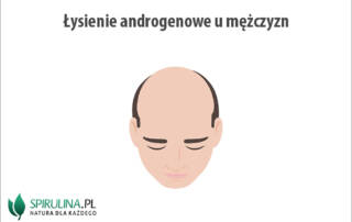 Łysienie androgenowe u mężczyzn