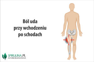 Ból uda przy wchodzeniu po schodach