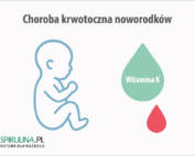 Choroba krwotoczna noworodków