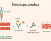 Choroba posurowicza