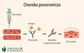 Choroba posurowicza