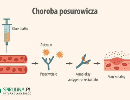 Choroba posurowicza