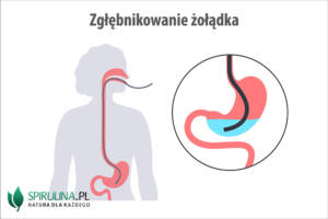 Zgłębnikowanie żołądka
