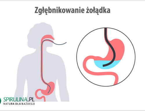 Zgłębnikowanie żołądka