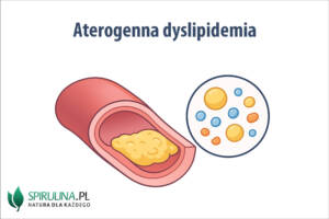Aterogenna dyslipidemia