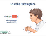 Choroba Huntingtona