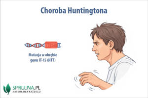 Choroba Huntingtona